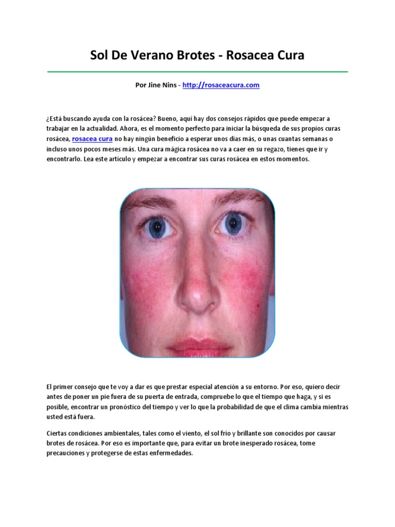 Rosacea Cura | PDF | Protector solar | Calor