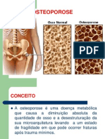 58576664 Osteoporose Trabalho Slide