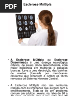 ESCLEROSE MULTIPLA