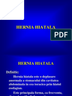 Hernia Hiatala
