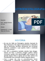 Eletroecefalografia