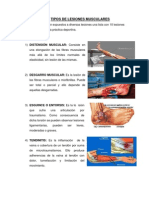 Tipos de Lesiones Musculares