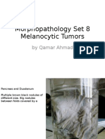 Morphopathology Set 8 Melanocytic Tumors: by Qamar Ahmad