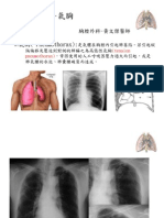 Pneumothorax