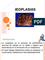 Neoplasias Usp