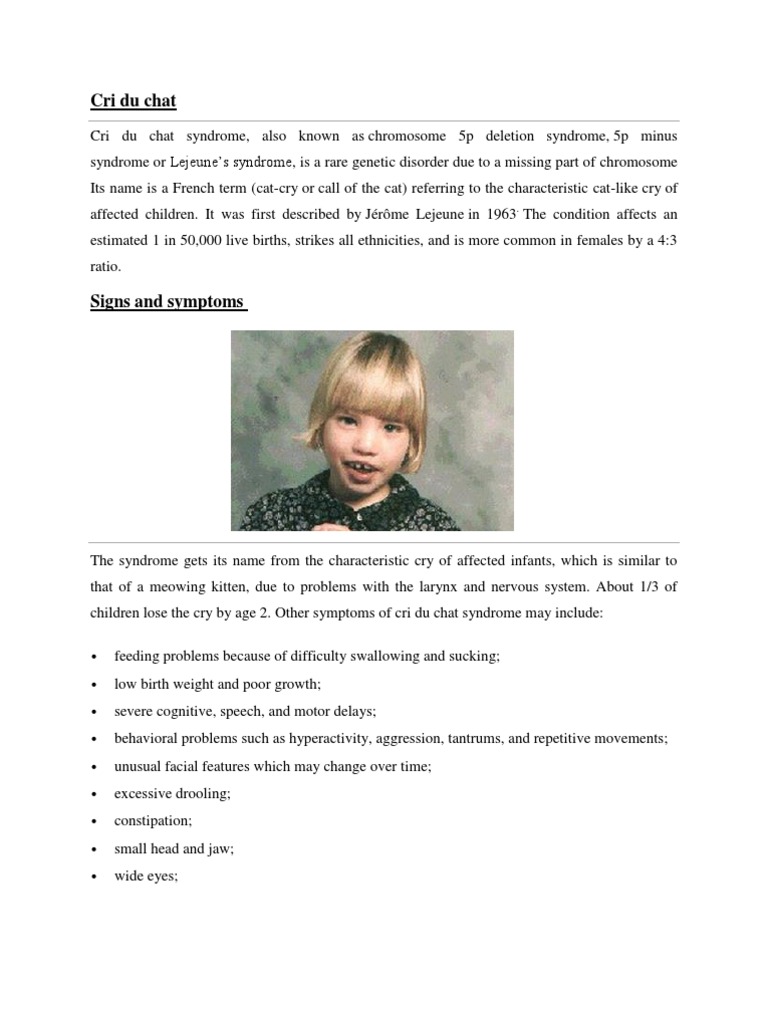 Cri Du Chat Genetics Medical Specialties