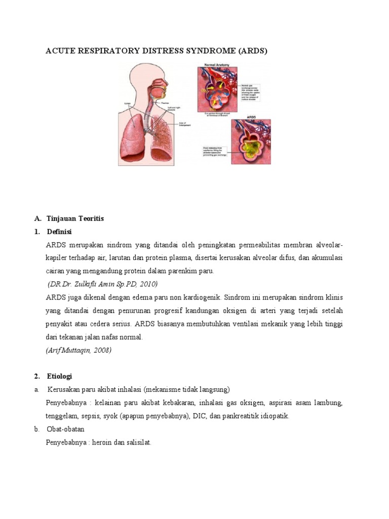 Acute Respiratory Distress Syndrome | PDF