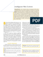 Benign and Premalignant Skin Lesions.31