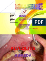 Exposicion Alveolitis Humeda