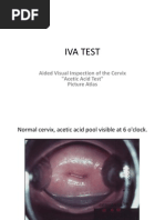 Download IVA TEST by Mata Langit SN146857223 doc pdf