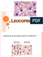 Causas y Tipos de Leucopenia: Neutropenia y Linfopenia