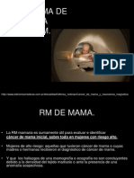 9.3 Carcinoma de Mama en RM.