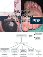 Tiñas, candidiasis y otras micosis cutáneas