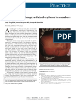 Practice: Harlequin Colour Change: Unilateral Erythema in A Newborn