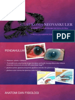 Referat Glaukoma Neovaskuler Powerpoint