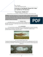 Steroid Induced Perforation of Gall Bladder-Report of A Rare Case and Review of Literature