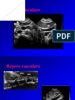 04-US Ficat - Hepatopatii Difuze