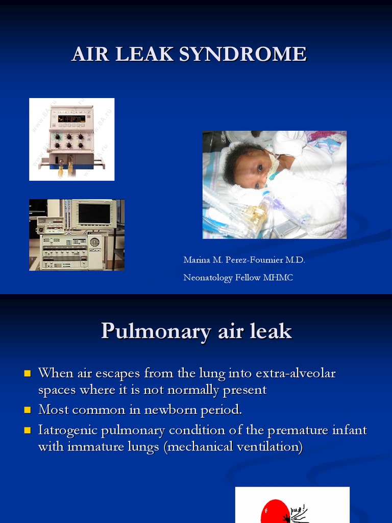 Air Leak Syndrome Lung Respiration