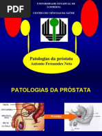 Patologias da Próstata
