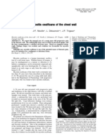 32317337 Myositis Ossificans of the Chest Wall