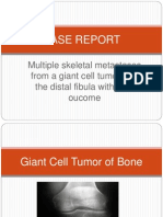 Case Report: Multiple Skeletal Metastases From A Giant Cell Tumour of The Distal Fibula With Fatal Oucome