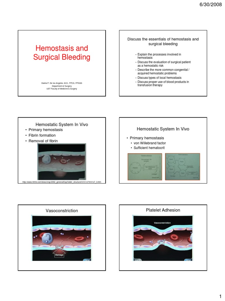Discuss The Essentials of Hemostasis and Surgical Bleeding | PDF ...
