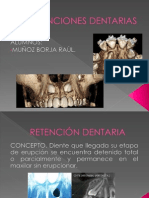 Retenciones Dentarias