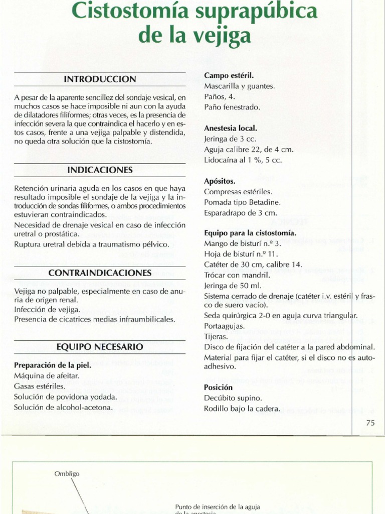 talla-vesical-o-cistostom-a-suprap-bica-pdf-vejiga-urinaria-urolog-a