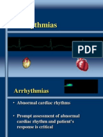 Chapter 35Arrhythmias