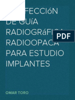 Confección de Guía Radiográfica radioopaca para estudio implantes