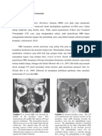  Sinusitis Paranasalis