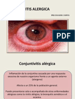 CONJUNTIVITIS