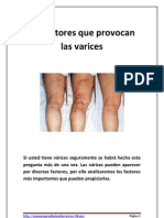 10 Factores Que Provocan Las Varices