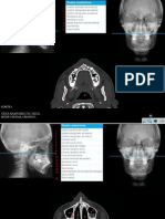 Taller Cbct