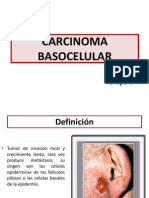 Carcinoma Basocelular FIN