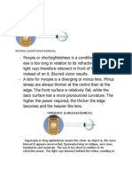 Common Eye Defects