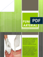 Punción Arterial