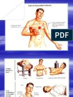 Ischemia.ppt