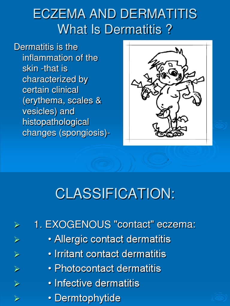 Eczema and Dermatitis Guide | PDF | Dermatitis | Inflammation
