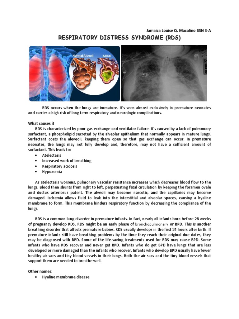Respiratory Distress Syndrome | PDF | Lung | Respiratory System