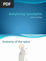 Download Ankylosing Spondylitis by Izni Fatihah SN150834542 doc pdf
