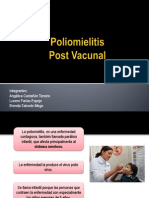 Poliomielitis: causas, síntomas y prevención