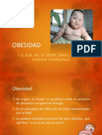 Obesidad