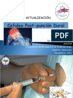 Cefalea Post-Punción Dural