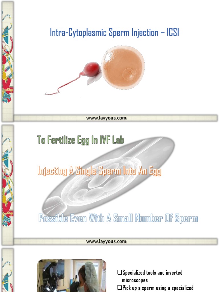 Intracytoplasmic Sperm Injection - ICSI. | Download Free PDF | Sperm | Egg