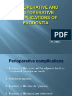 Complication of Exodontia