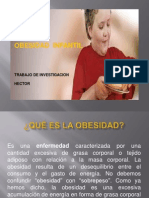 La Obesidad Infantil