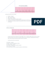 ECG Normal Sinus Rhythm Guide