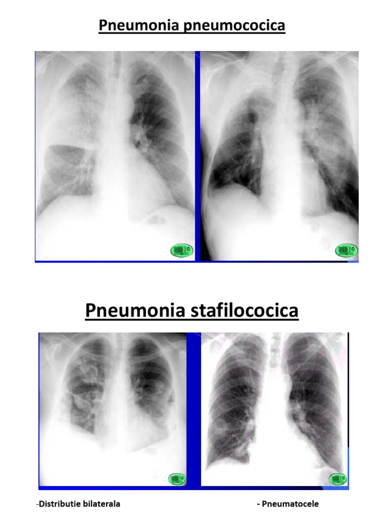 RX Pulmonar | PDF | Ciencia y matemáticas