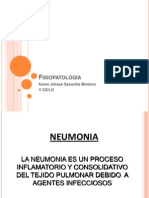 Neumonia